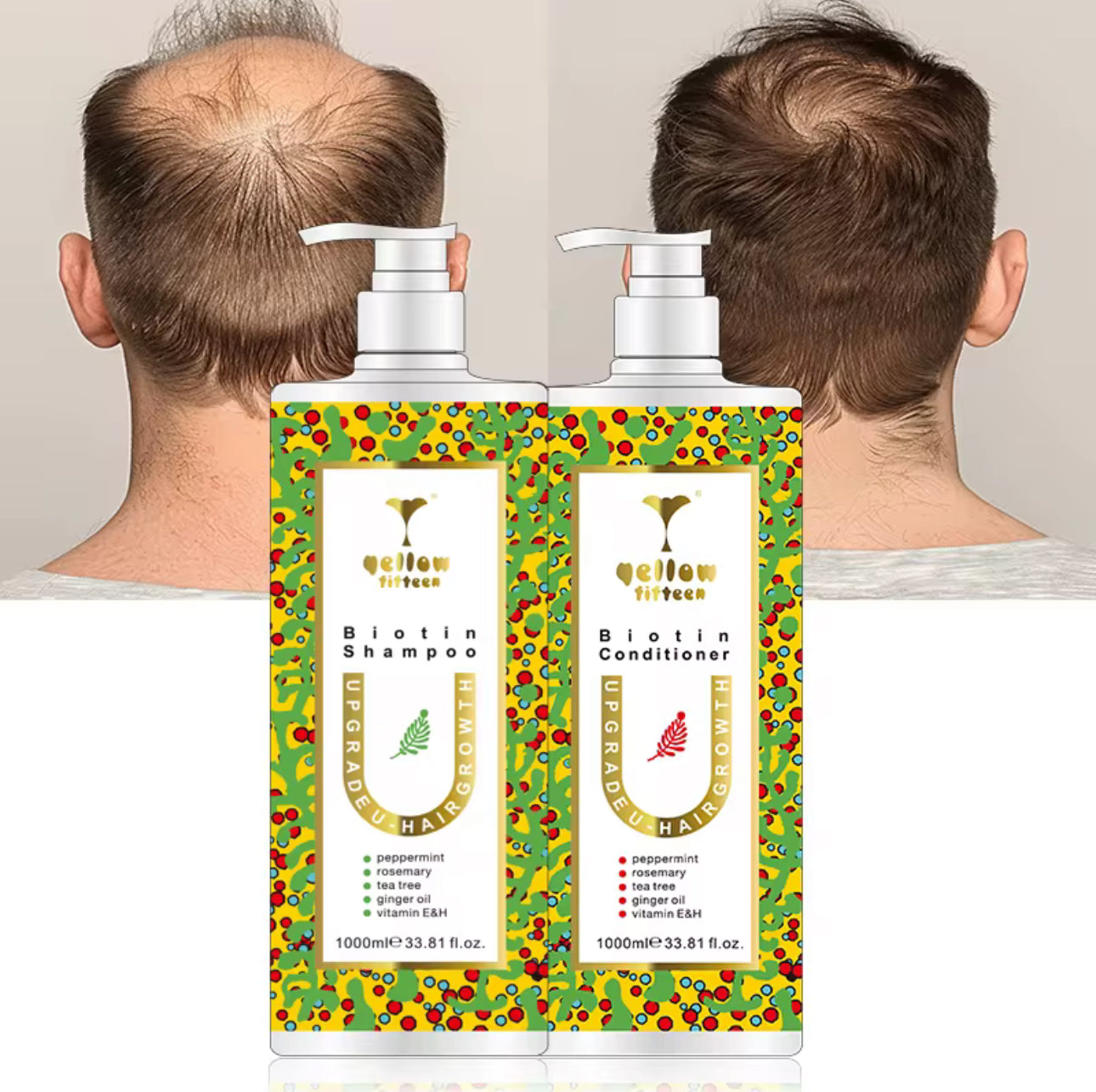Revitalizing Hair Trio – Scalp Therapy with Rosemary, Mint & Biotin
